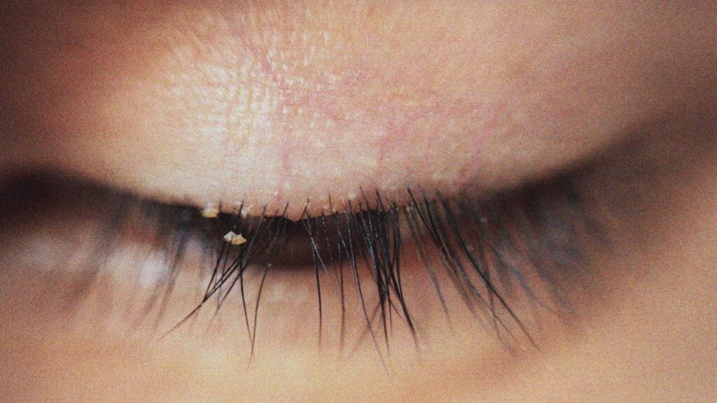 Allure